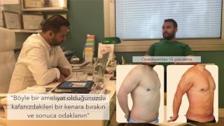 Vaser Liposuction Hasta Röportajı [upl. by Anirret]