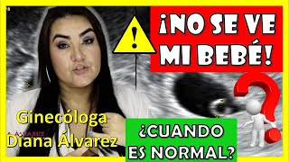 ⚠SACO GESTACIONAL SIN BEBÉ❗ ¿Hasta cuando es NORMAL❓ por GINECOLOGA DIANA ALVAREZ [upl. by Trout]