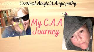 Do I have the signs of Vascular Dementia My CAA Journey Cerebral Amyloid Angiopathy [upl. by Nnylyahs]