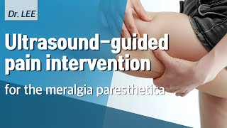 TAnatomy and US guided pain intervention for the meralgia paresthetica PRF treatement [upl. by Gnaw104]