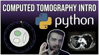 CT Scans and Tomographic Recon in PYTHON [upl. by Ruthanne]