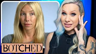 BOTCHED Is 24 trans plastic surgeries too many volume 3 [upl. by Barrett]