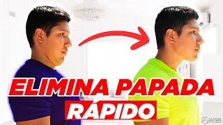 🔴 5 EJERCICIOS para ELIMINAR y REDUCIR la PAPADA en SOLO 3 MINUTOS😱 [upl. by Tabbitha377]