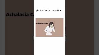 Achalasia caradia kattrucate medicalreels achalasia peristaltic triads oesophagus nerves [upl. by Scribner]