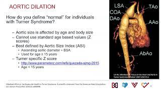 Cardiac Imaging in Turner Syndrome [upl. by Nylsirk]