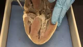 Cardiovascular system Part 3a  Heart dissection [upl. by Hiroshi]