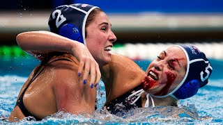 The Top 5 Most Devastating Water Polo Injuries of All Time [upl. by Orecul]