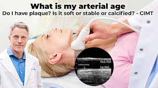 What is My Arterial Age Do I Have Plaque Is It Soft or Stable or Calcified CIMT [upl. by Eornom407]