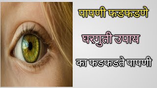 पापणी फडफडणे घरगुती उपायडोळा लवणेScientific Reason Behind Eye Blinking 👁️ पापणी का फडफडते [upl. by Uriia]