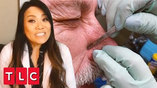 Blackhead Bonanza  Dr Pimple Popper This is Zit [upl. by Varick]