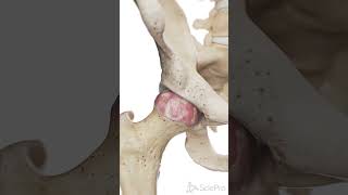 🦴 Understanding Hip Arthrosis Wear and Tear of the Hip Joint 🦴 anatomy [upl. by Ender]