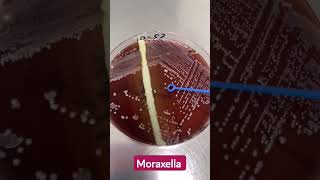 Microbiology lab diagnosis of Moraxella intact colonies [upl. by Eidualc329]