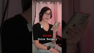 Voice Surgery 2 Week Results [upl. by Stu]