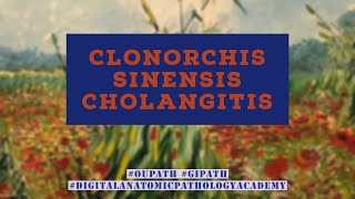 Clonorchis sinensis cholangitis [upl. by Westney137]