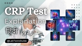 CRP Test Guidelines Your Guide to Inflammation and Health [upl. by Burrill]