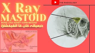 X Ray Mastoid Bone behind the ear in urduhindi कर्णमूल [upl. by Gurango]