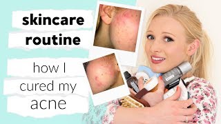 My full skin care routine amp how I CURED my acne [upl. by Eanod423]