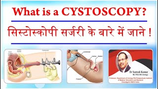 What is a Cystoscopy  सिस्टोस्कोपी सर्जरी के बारे में जाने  DrProfSantosh Kumar PGI [upl. by Aicilanna]