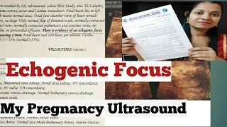 Echogenic Focus  My Pregnancy Ultrasound [upl. by Trix]