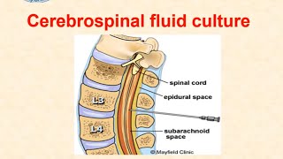 Cerebrospinal fluid culture  dr Ismail [upl. by Selry961]