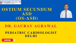 Ostium Secundum Atrial Septal Defect OSASD Dr Gaurav Agrawal Pediatric Cardiologist New Delhi [upl. by Aeel]