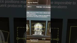 MRI Brain Scan diagnosticradiology mri radiology anatomy science breastimaging [upl. by Ailemac]