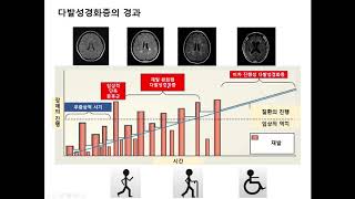 다발성경화증의 치료 1 [upl. by Payton569]