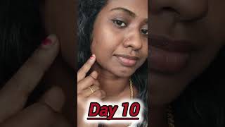 🔥Glutathione Skin Whitening Challenge😱കിടിലൻ റിസൾട്ട്‌ ഗുയ്സ്‌😱💯Chic nutrix Glow💯glutathione [upl. by Reemas]