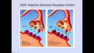 Brockmann Vesicular Synapse chpt 13 part 4 [upl. by Sell]