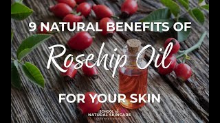 9 Natural Benefits of Rosehip Oil for Your Skin [upl. by Brace103]