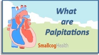 What are Palpitations [upl. by Xxam]