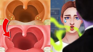 ASMR💋Bad breath before kissing Tonsil stone removal animation  tonsil stones extrusion [upl. by Amargo]