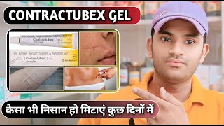 Contractubex gel uses dose benefits and side effects full review in hindi [upl. by Elleinad]