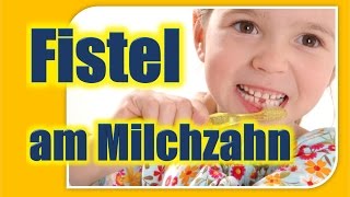 Warum ein Milchzahn mit einer Fistel gezogen werden muss [upl. by Aceissej]