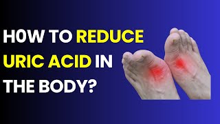 Natural Ways to Lower Uric Acid Levels in the Body Health Miracles [upl. by Gnud542]