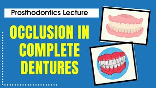 Occlusion in Complete Dentures  Prosthodontics Lecture  Dr Manase [upl. by Jet942]