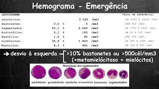 Avaliação rápida do hemograma [upl. by Ayahsey]