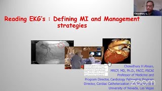 Myocardial Infarction Basic to Bedside Lecture 85 [upl. by Eserahs]