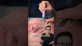 Pomada no Olho 😱👁️ medico medicina enfermagem enfermeira curiosidades anestesia saude [upl. by Ash]