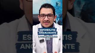 ¡Dolor lumbar persistente Consulta a un reumatólogo 🤕🦴EspondilitisAnquilosante [upl. by Attelliw]