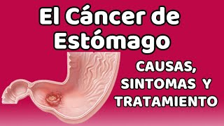 EL CÁNCER DE ESTÓMAGO Causas signos y síntomas diagnóstico y tratamiento [upl. by Eiznil533]