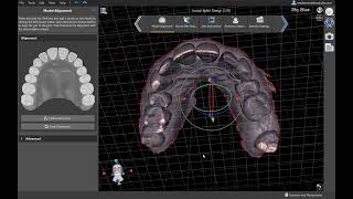 BSPV411 Creating a Splint With An Anterior Deprogrammer in BlueSkyPlan [upl. by Jasper]