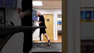 Rich Rotationplasty Amputee Running with a Custom Running Blade Prosthesis [upl. by Eddi]