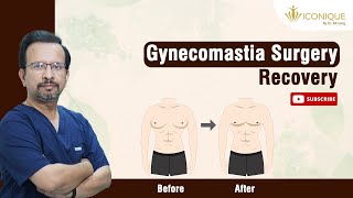 Gynecomastia Surgery Recovery Time  Gynecomastia Surgery  Gynecomastia Surgery Recovery Time [upl. by Arrek]