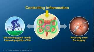 Chronic Inflammation in IBD and How AntiTNF Therapy Works [upl. by Bolt]