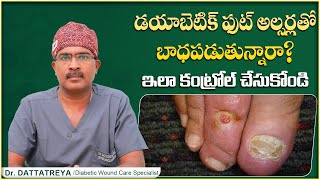 How to Manage Diabetic Foot Ulcer  Diabetic Foot Ulcer Treatment in Telugu  Wound Care Hospitals [upl. by Alemaj]