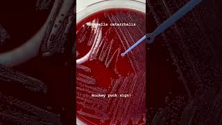 Moraxella catarrhalis Hocky Puck sign microbiology [upl. by Krall]