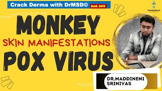 Monkey Pox virus  MPOX  Dermatological  SKIN Manifestations DrMSD Dr Maddineni Srinivas  WHO [upl. by Lanni]