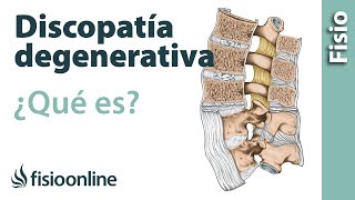 Discopatía degenerativa  ¿Qué es [upl. by Korman]