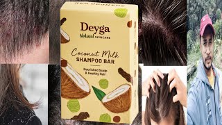 Deyga Coconut Milk Shampoo Bar  Honest Review [upl. by Kabab736]